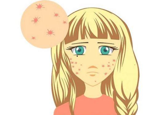 起痘痘吃瓜,瓜果助力健康肌肤